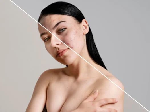 Soins & Traitement Visage — Soins esthétiques chez Epil House à Rabat